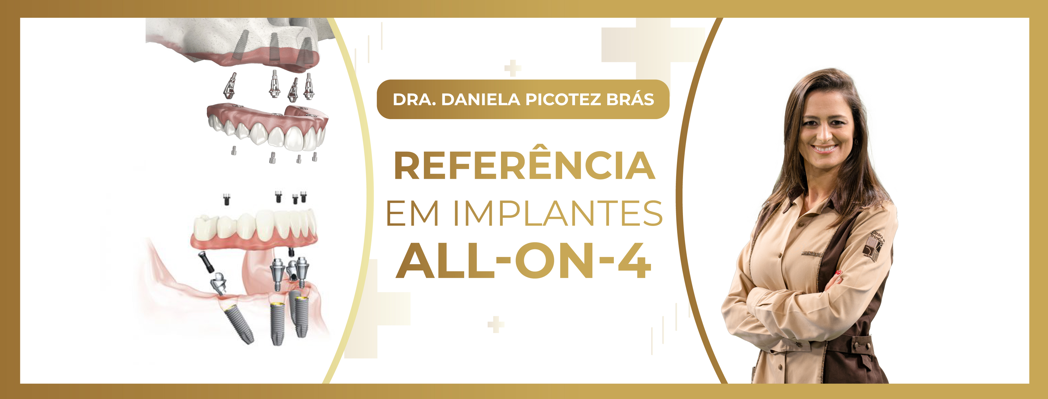 Referência em implantes